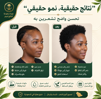 زيت الباتانا الأصلي 100% — لشعر أكثر كثافة وقوة وصحة